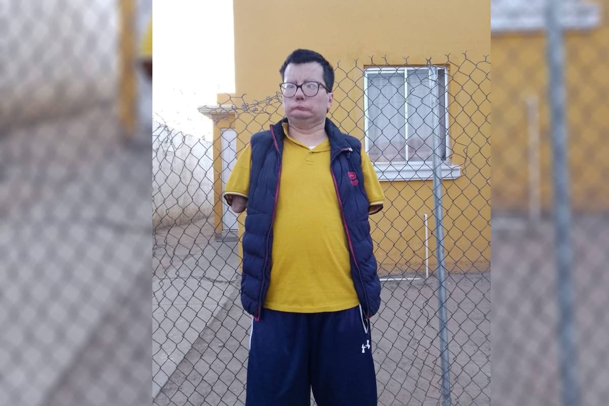 David nació sin manos y ahora necesita una nueva prótesis para moverse, el joven busca apoyo