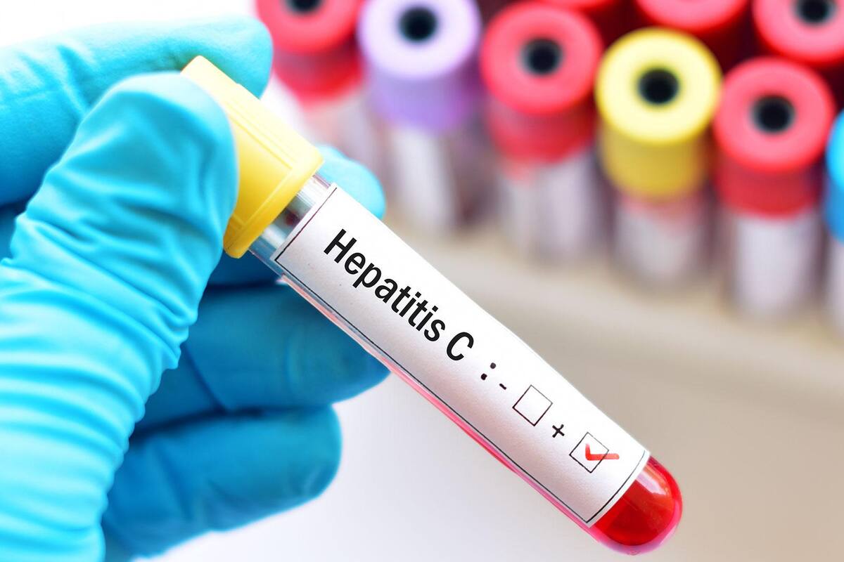 México pone en marcha plan nacional para erradicar la hepatitis C