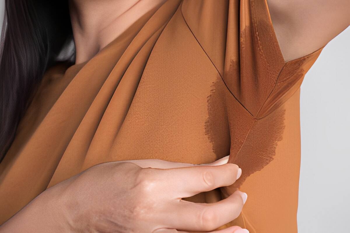 Causas de la sudoración excesiva y cómo tratarla