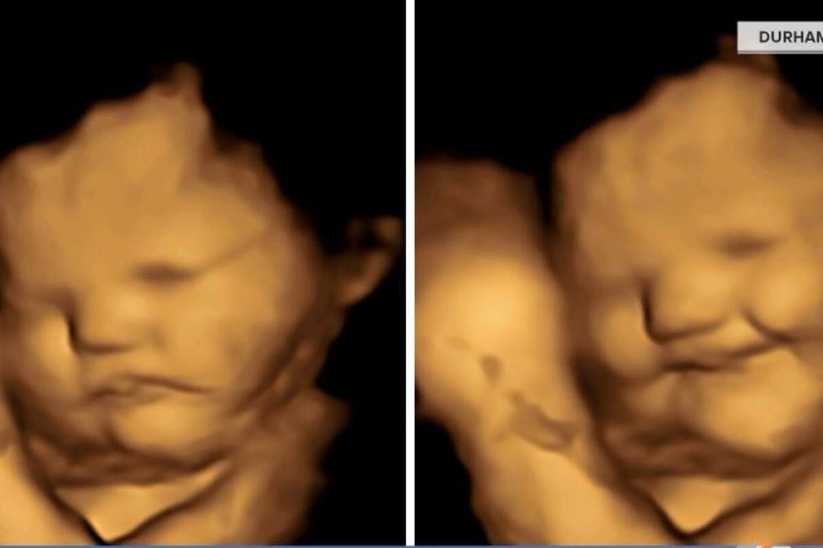 Estudio muestra que fetos sonríen cuando sus madres comen zanahoria, pero hacen muecas con la col rizada