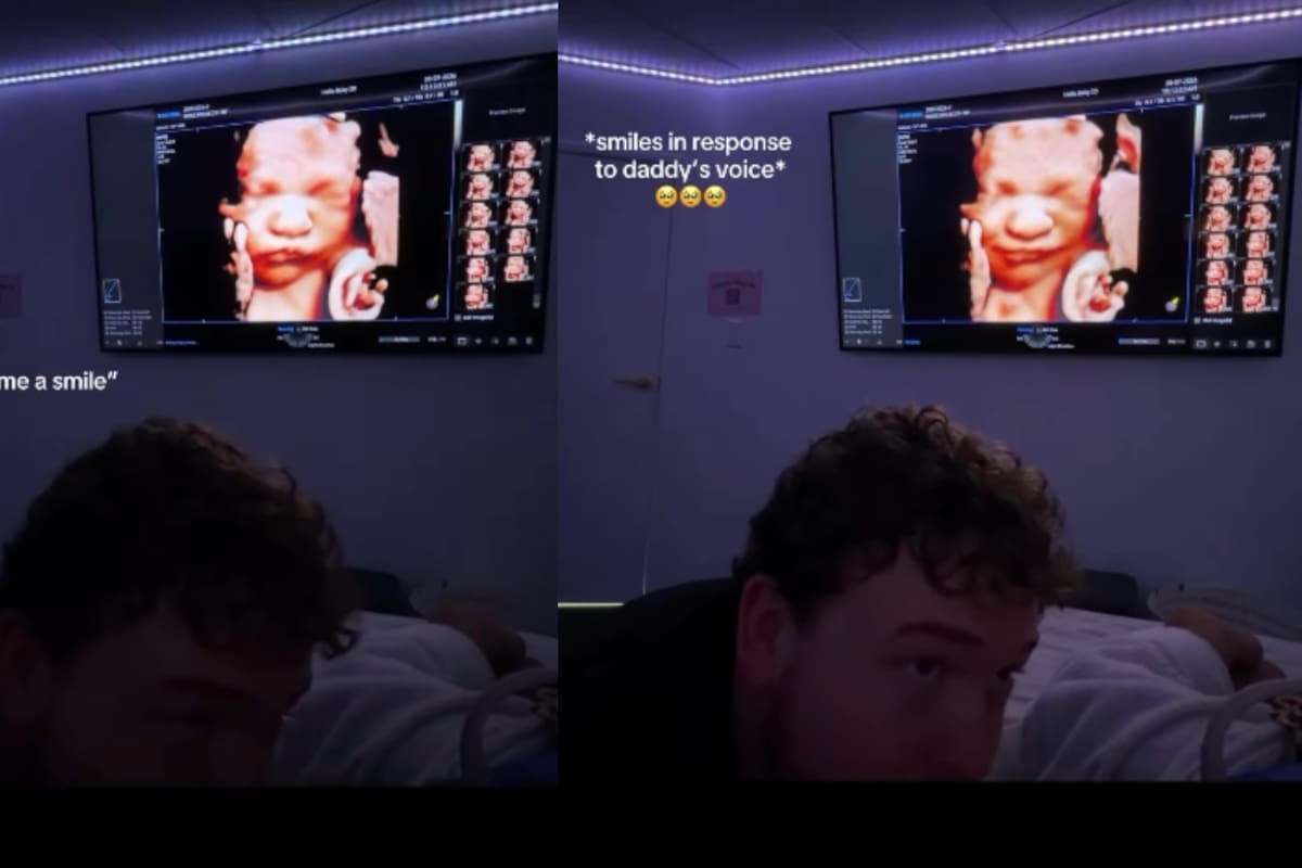 “Le pidieron a su bebé que sonriera y él lo hizo”: Padres viven un enternecedor momento durante un ultrasonido de 30 semanas