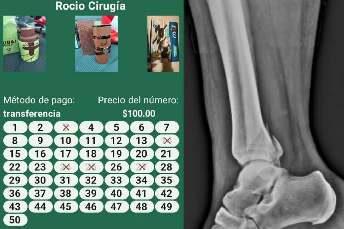 Enfermera invita a rifa operarse el tobillo