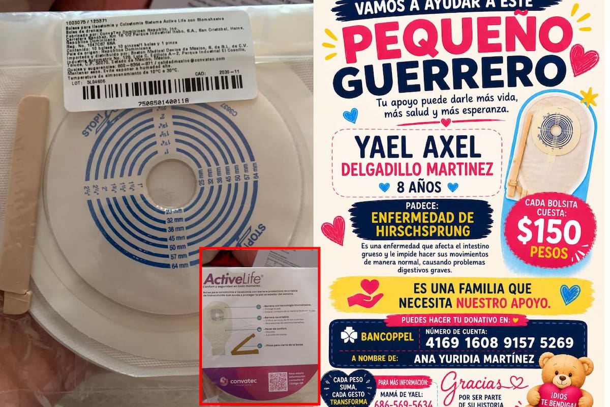 Yael lleva 8 años luchando contra la enfermedad de Hirschsprung: Su familia pide ayuda para costear bolsas de ileostomías