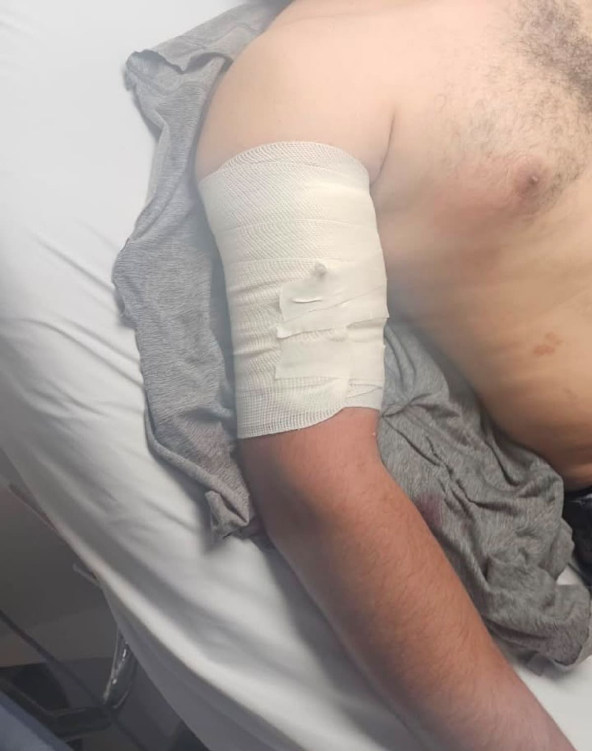 Un hombre de aproximadamente 40 años llegó por sus propios medios a la Cruz Roja con una lesión de bala en el brazo derecho.
Fotos: Carmen Gutiérrez.