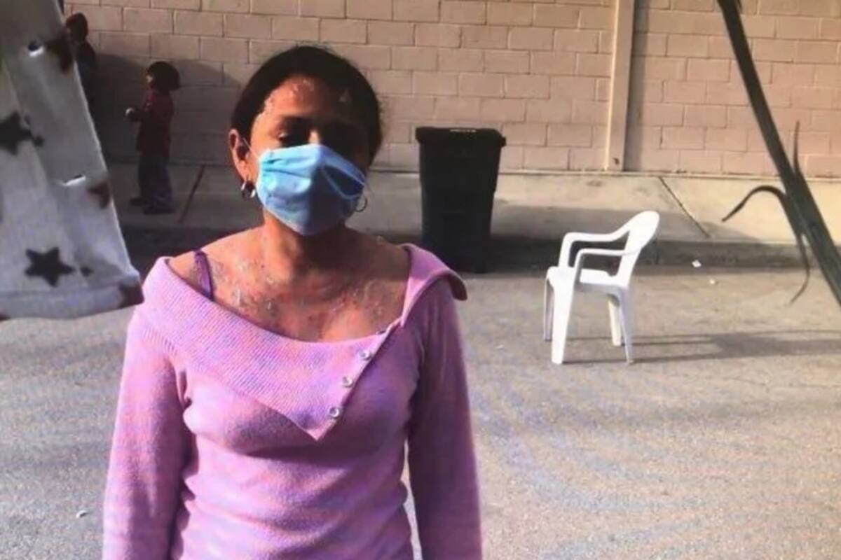 Ponen en cuarentena a albergue migrante tras brote de varicela