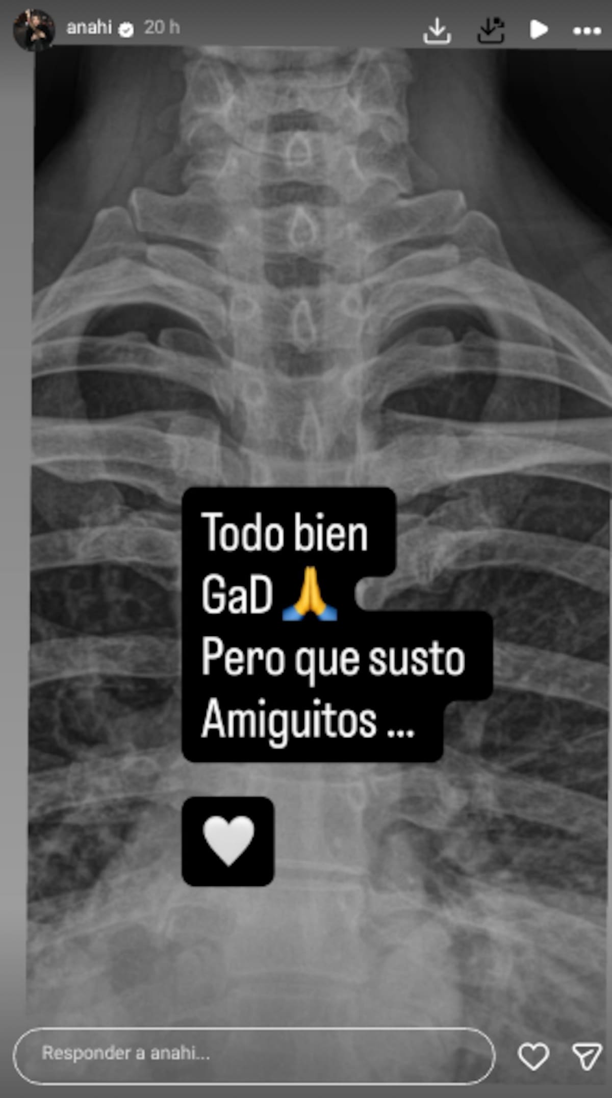 Anahí preocupa a sus seguidores tras sufrir una fuerte caída durante su rutina de ejercicio | IG (@anahi)