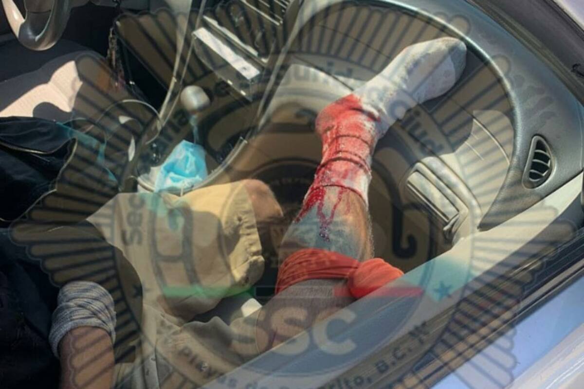 Lesionan a hombre de un tiro en la pierna en Rosarito