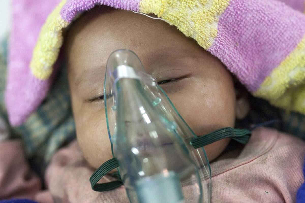 Los ingeniosos inventos que salvan la vida de niños que necesitan oxígeno desesperadamente