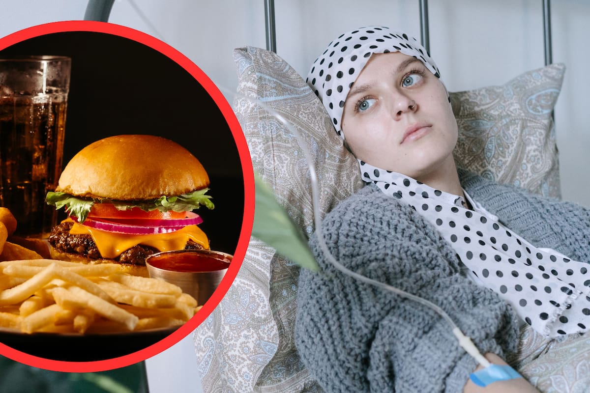 Un estudio detecta más pólipos tempranos en mujeres que consumen ultraprocesados