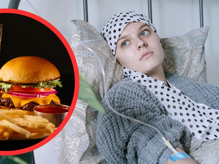 Un estudio detecta más pólipos tempranos en mujeres que consumen ultraprocesados