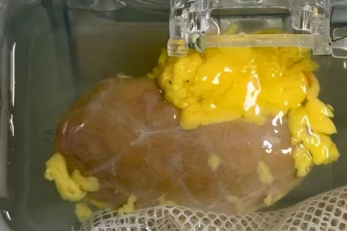 Científicos crean riñón universal que concuerda con cualquier tipo de sangre