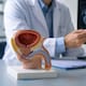 Un nuevo estudio encontró una forma de detectar el cáncer de próstata que evita biopsias innecesarias en seis de cada diez hombres