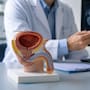 Un nuevo estudio encontró una forma de detectar el cáncer de próstata que evita biopsias innecesarias en seis de cada diez hombres