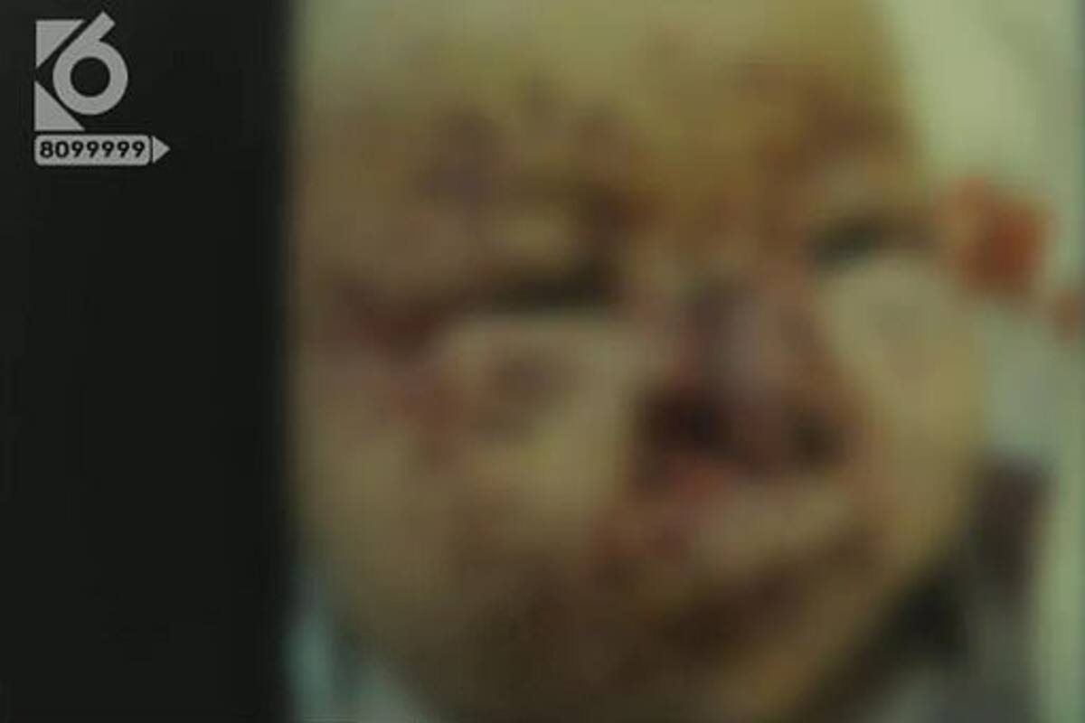 Padres olvidan limpiarle la carita a su bebé y ratones le carcomen el rostro