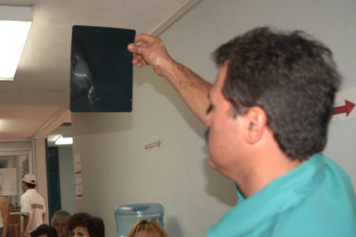 Disminuye 30% la detección de cáncer de mama