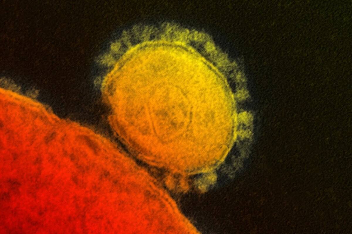 Revelan expertos todo lo que se sabe de la nueva mutación doble del SARS-CoV-2