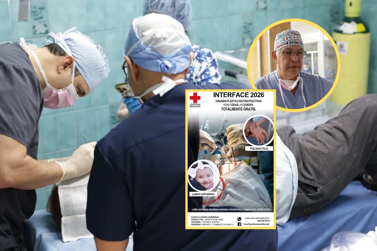 Realizarán 32 cirugías gratuitas de labio leporino con apoyo de voluntarios internacionales