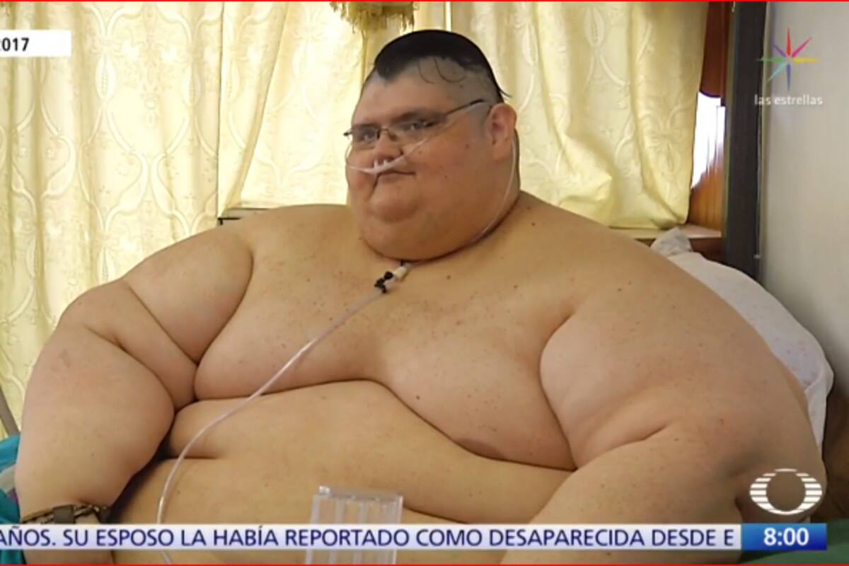 Juan Pedro perdió más de 300 kilos de los 600 que pesaba y ya puede caminar