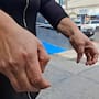 Por presunta negligencia teme perder movilidad de sus manos