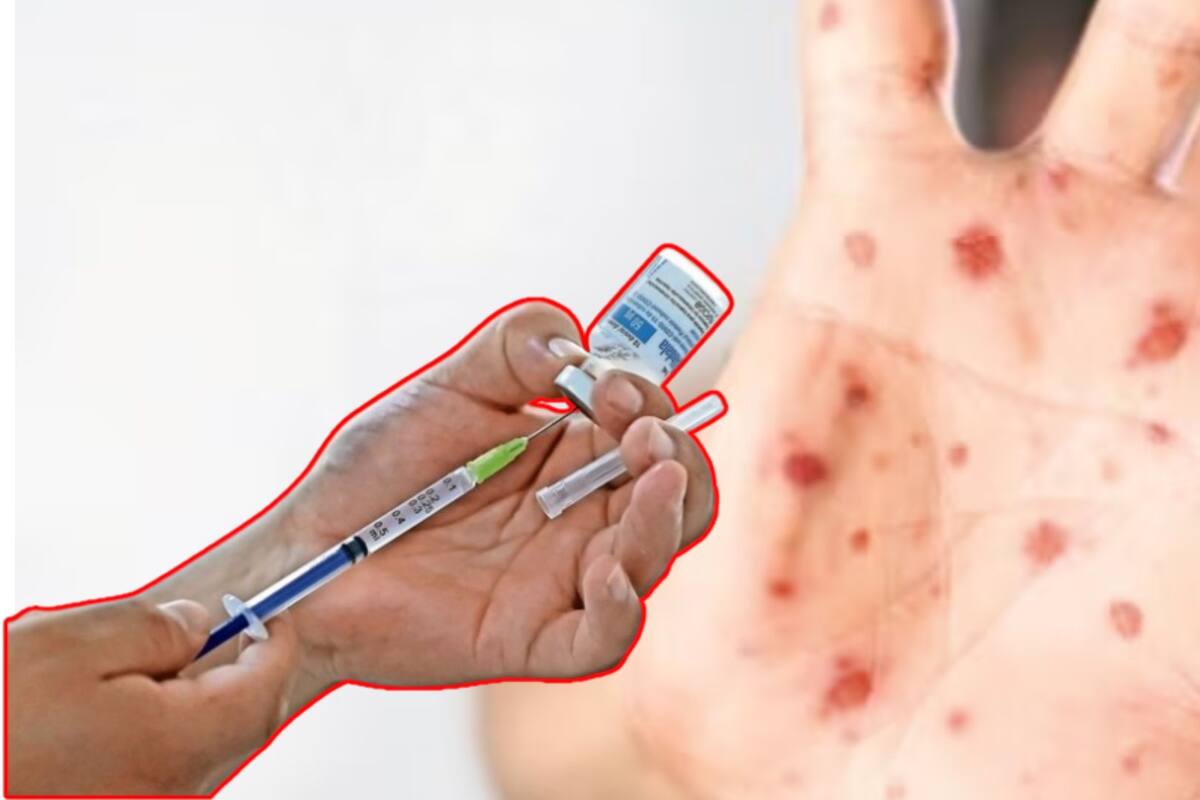 Brote masivo de sarampión golpea la frontera: El Paso y Ciudad Juárez en alerta por contagios vinculados a comunidades menonitas