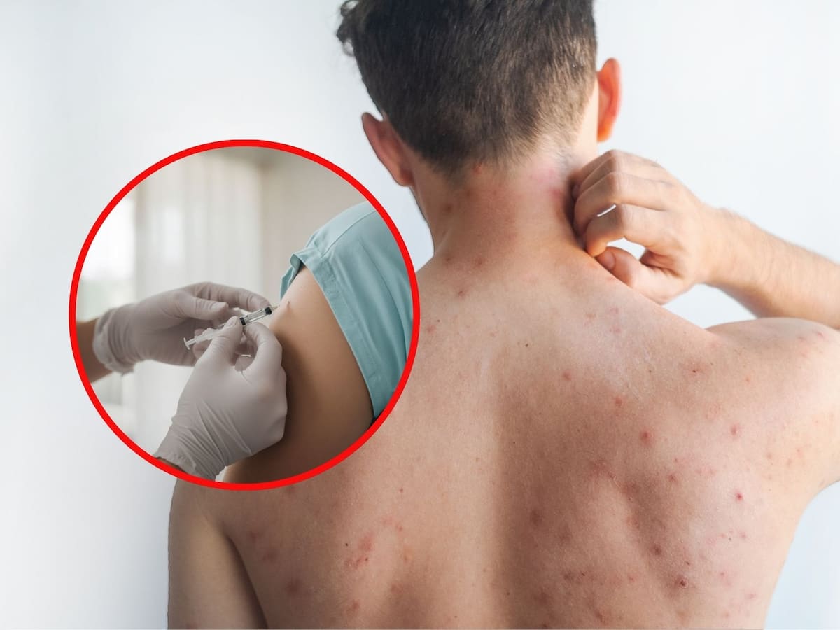 Brote de sarampión activa vacunación masiva en México: niños y adultos de 20 a 49 años son prioridad; expertos detallan quién sí y quién no debe inmunizarse. | Crédito: Canva