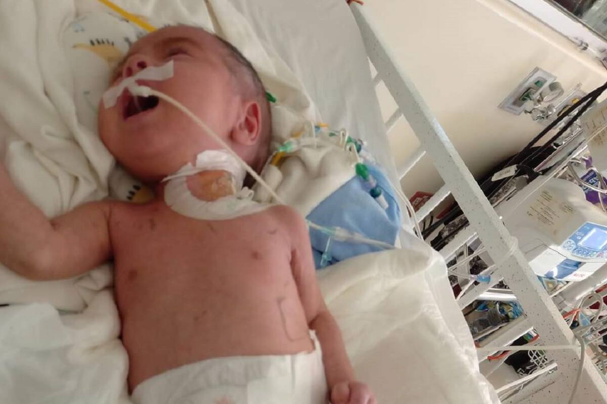 Solicitan apoyo para solventar gastos médicos de Gerardo, de 6 meses