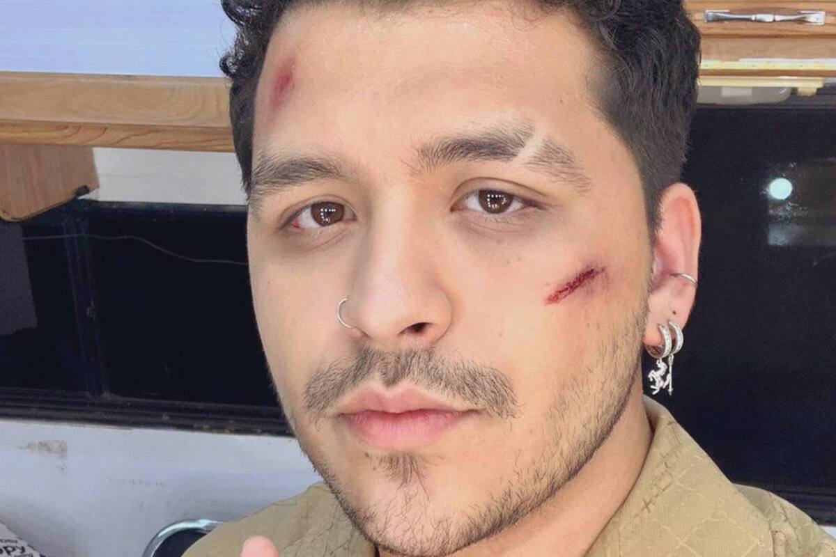 “¿Fue Belinda?”: Christian Nodal aparece con golpes en la cara