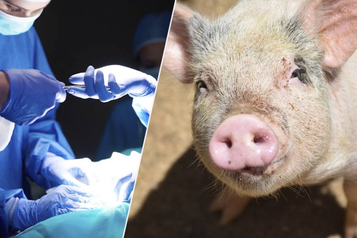 Estados Unidos probará hígados de cerdo modificados genéticamente como puente para tratar insuficiencia hepática