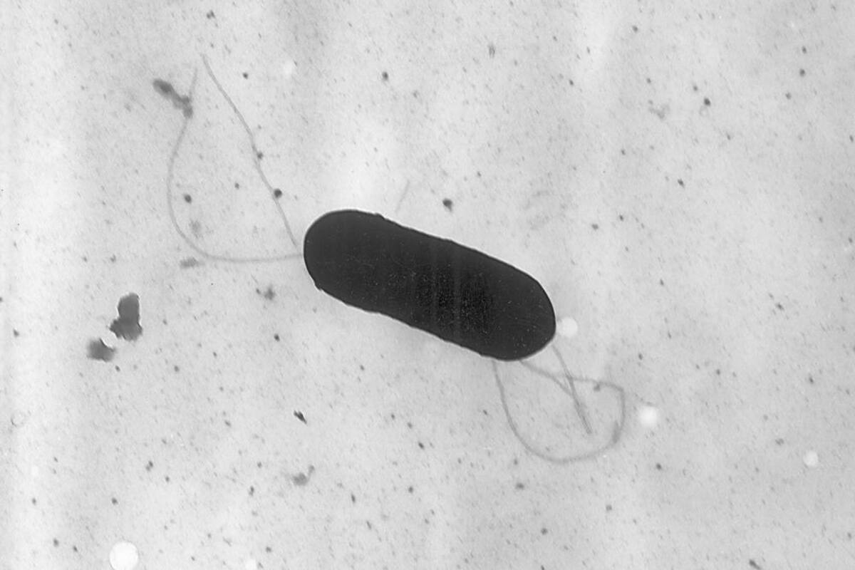 EU: Nuevo brote de listeria es vinculado a 23 hospitalizados y una muerte