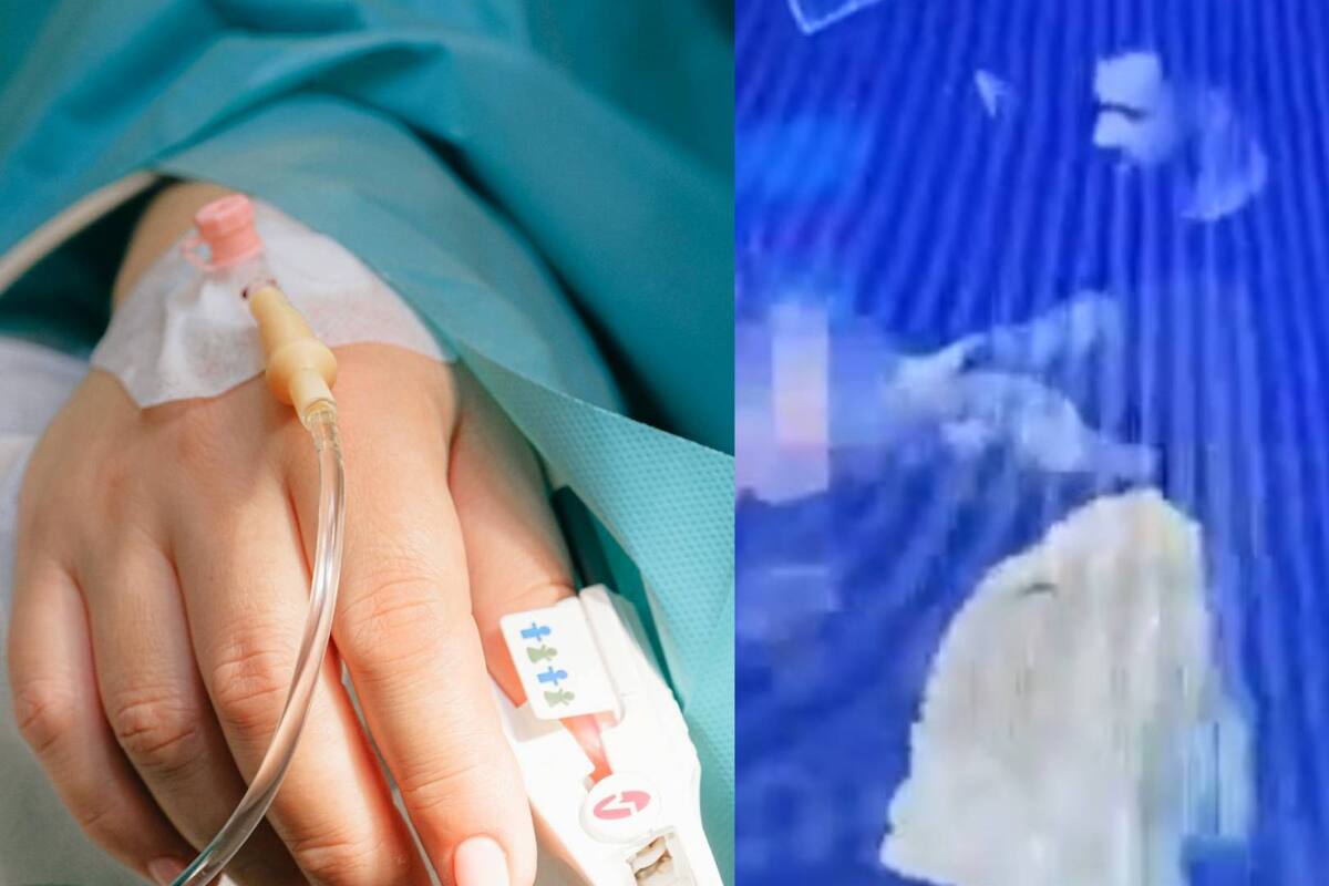 24 shots de alcohol consumió joven en bar de Moscú y queda en coma (VIDEO)