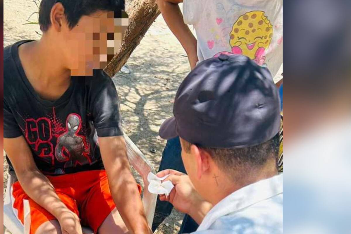 Policías rescatan a menor con lesiones en la cabeza y brazos tras caer de su bicicleta en Hermosillo