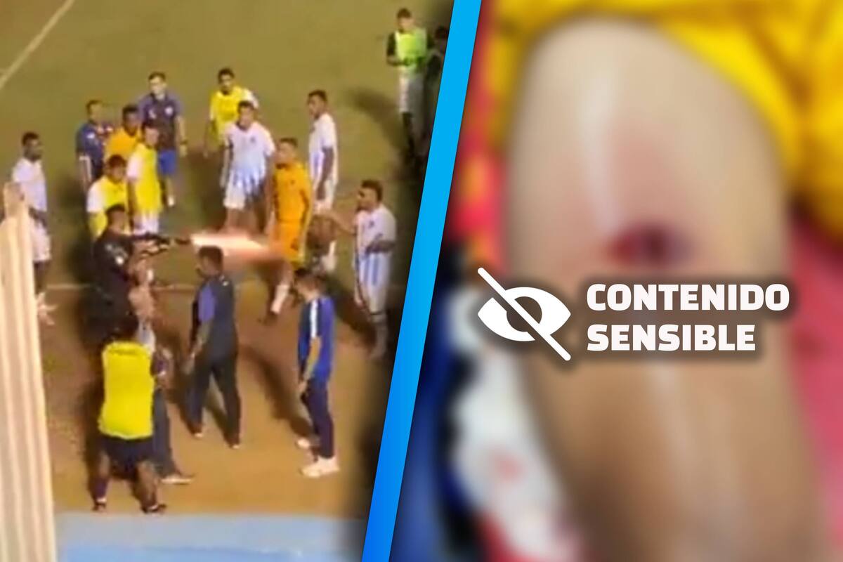 VIDEO: Policía le dispara a futbolista brasileño en plena cancha