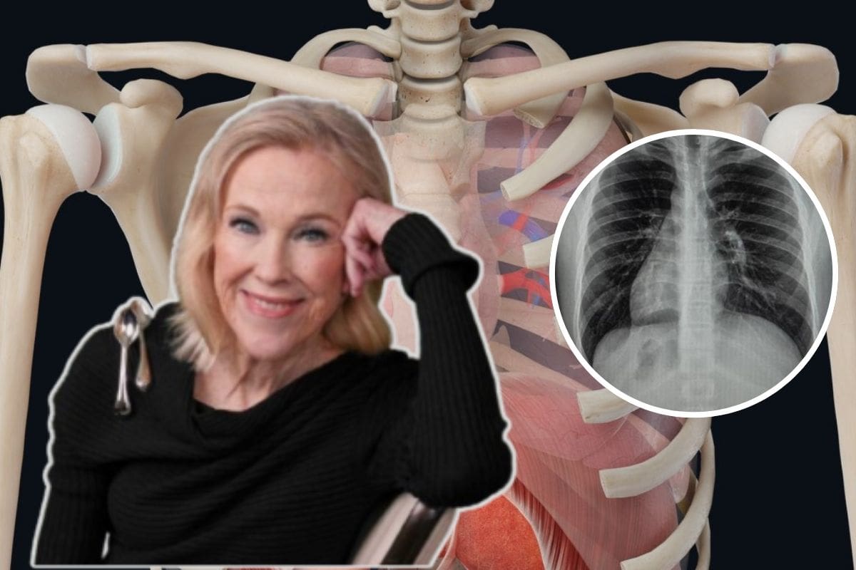 ¿Qué es el situs inversus y la dextrocardia? La extraña condición con la que vivía Catherine O’Hara