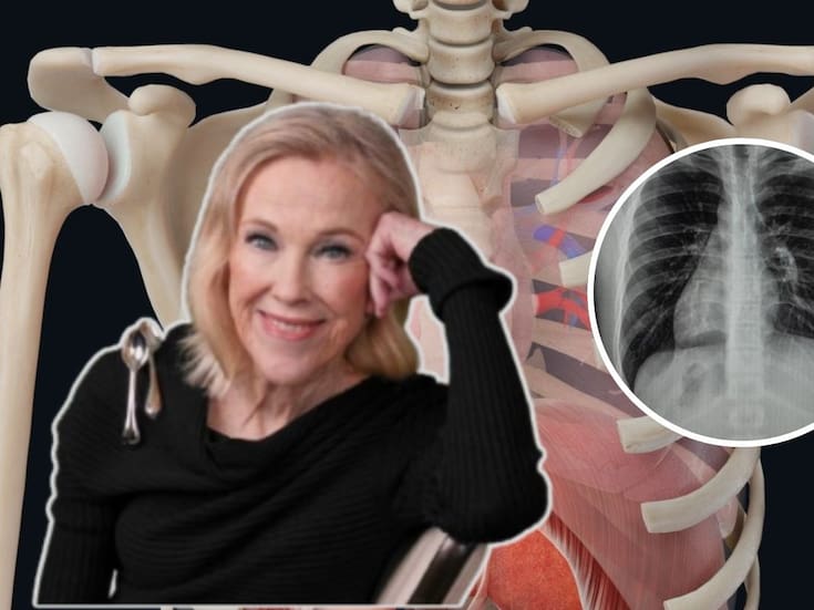 ¿Qué es el situs inversus y la dextrocardia? La extraña condición con la que vivía Catherine O’Hara