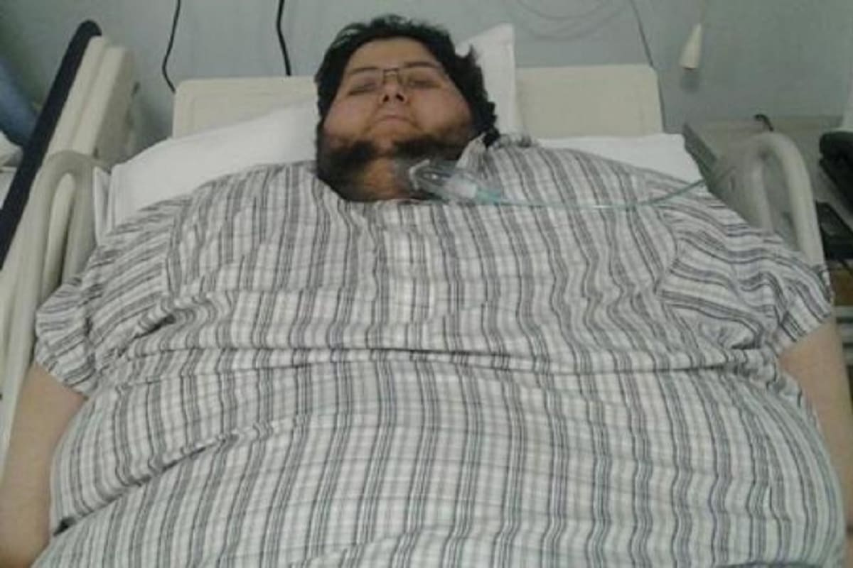El hombre más pesado de la historia y que logró bajar 542 kilos