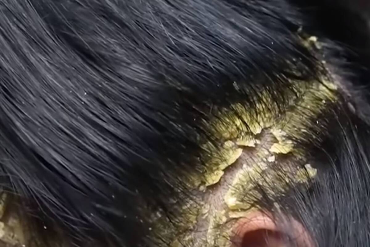 ¿Qué ocurriría si nunca te lavas el pelo?