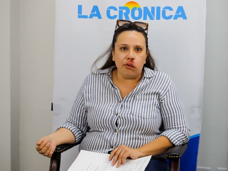 Mujer con tumor cerebral denuncia retrasos en atención y traslados del IMSS