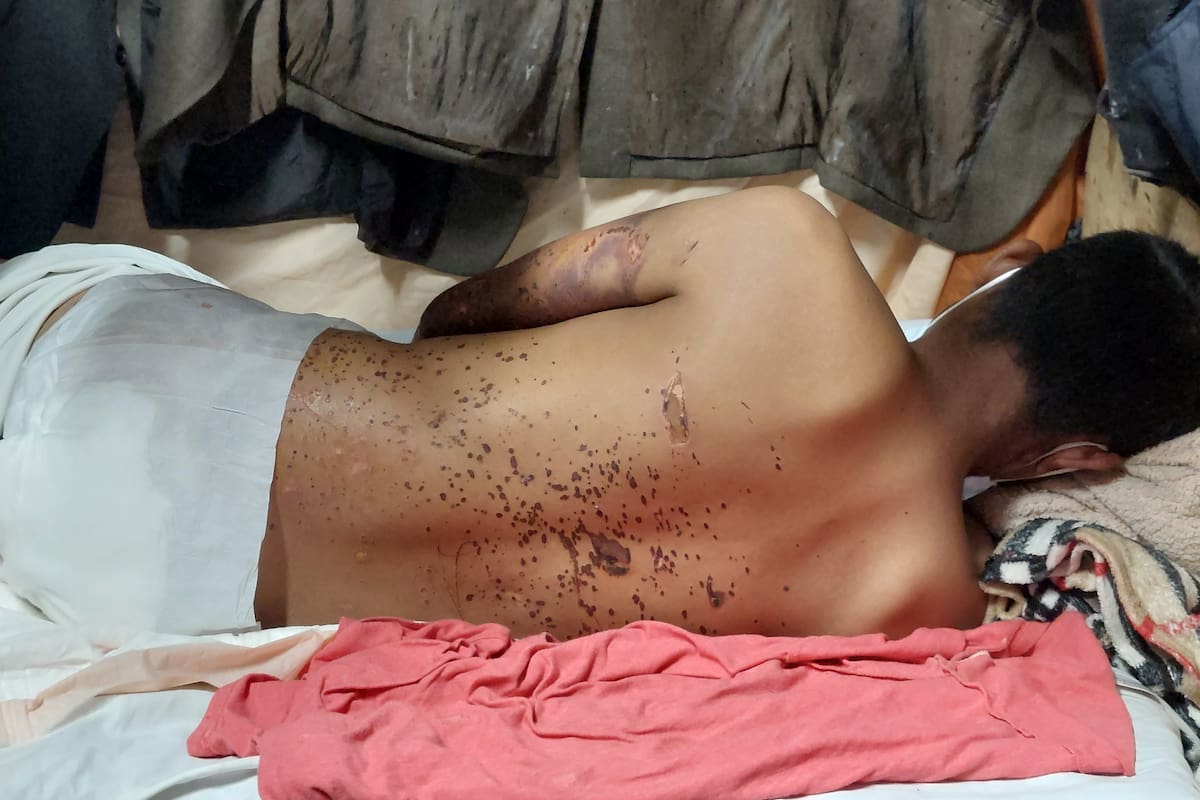 Ruega por ayuda migrante que sobrevivió a un intento de homicidio