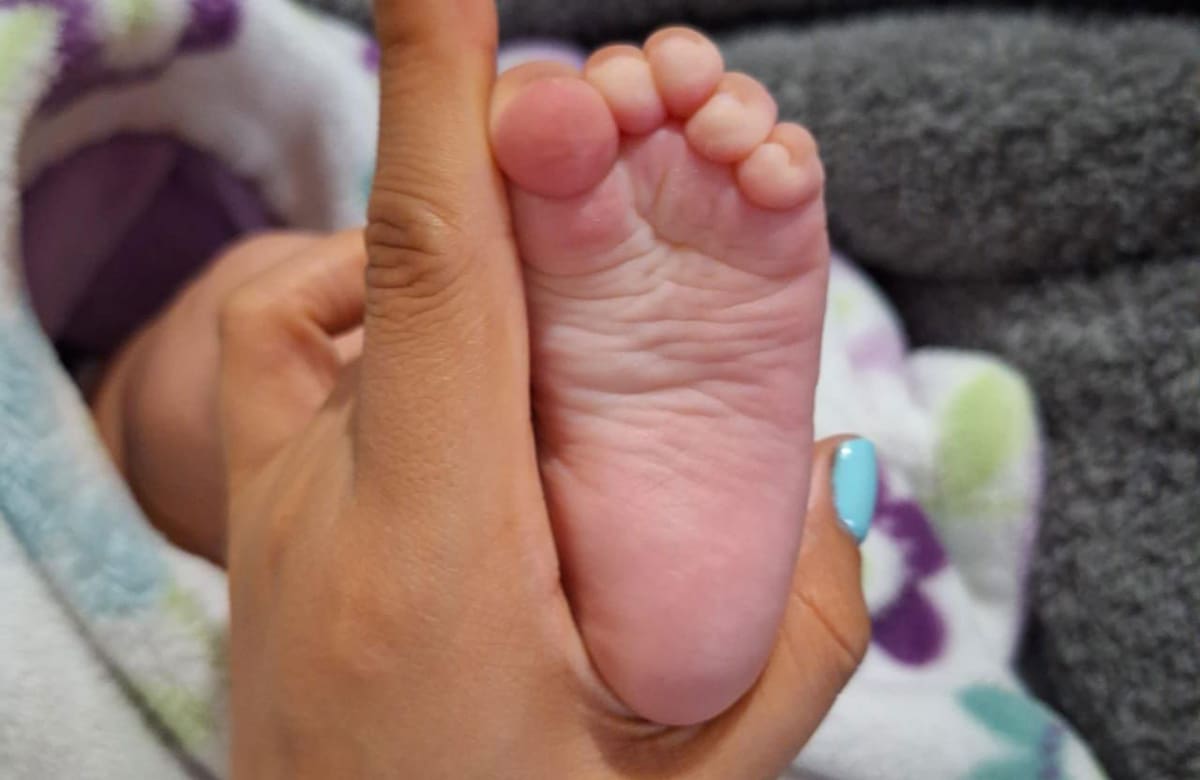 Entre el tercer y quinto día del nacimiento del bebé es que se deben realizar las pruebas de tamiz neonatal. Foto: Cortesía