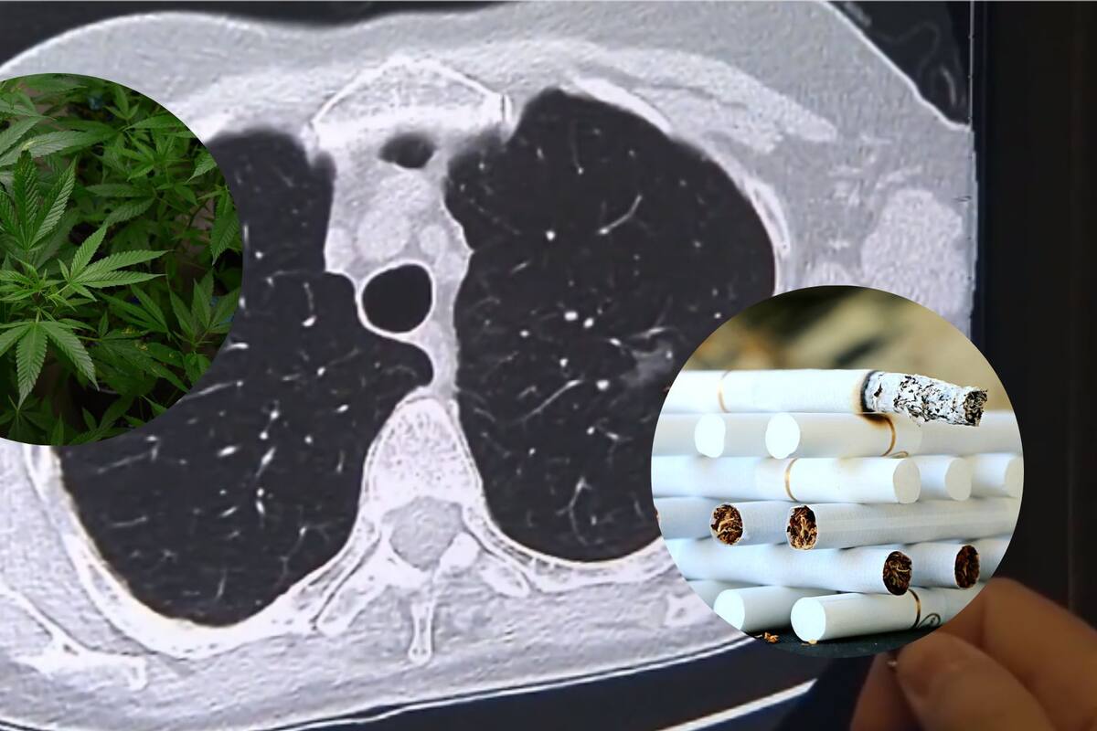 Un nuevo estudio reveló que la marihuana es más dañina para los pulmones