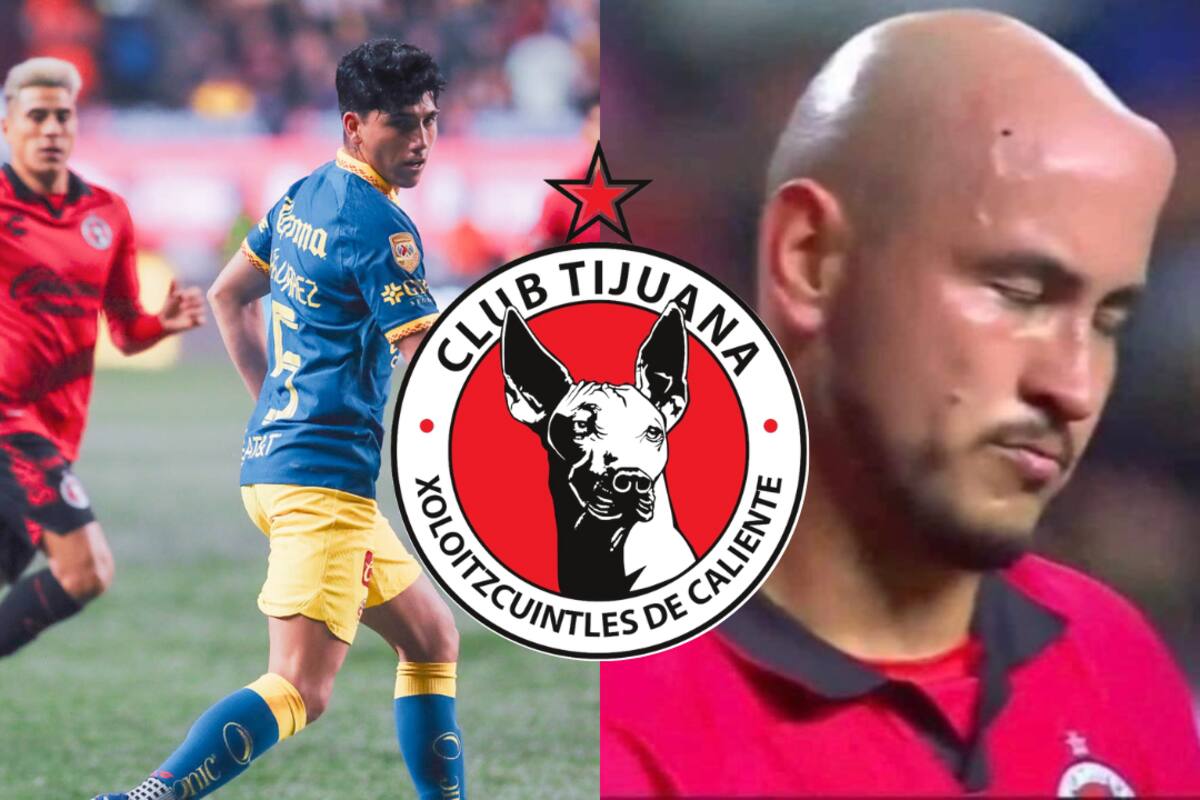 ¿Qué le pasó a Carlos Gonzalez en la cabeza?: Así quedó el 'chichón' de 'Cocoliso' ante el América