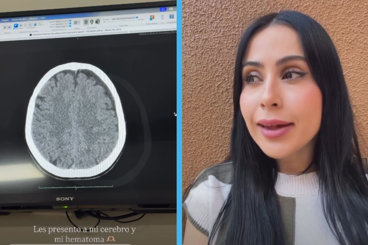Lupita Villalobos actualiza su estado de salud por hematoma subdural: “No me van a abrir la cabeza”