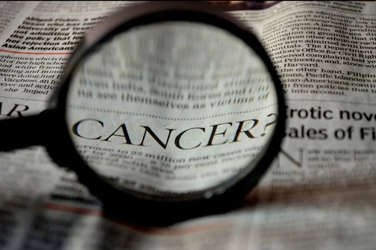 Epidemia mundial de cáncer en menores de 50 años podría estar surgiendo, revela estudio