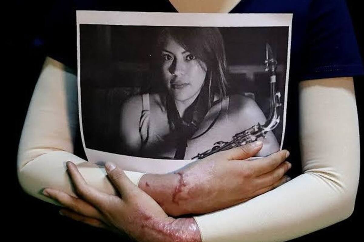 Gobierno de CDMX publica “Ley Malena”; ataques con ácido serán considerados tentativa de feminicidio