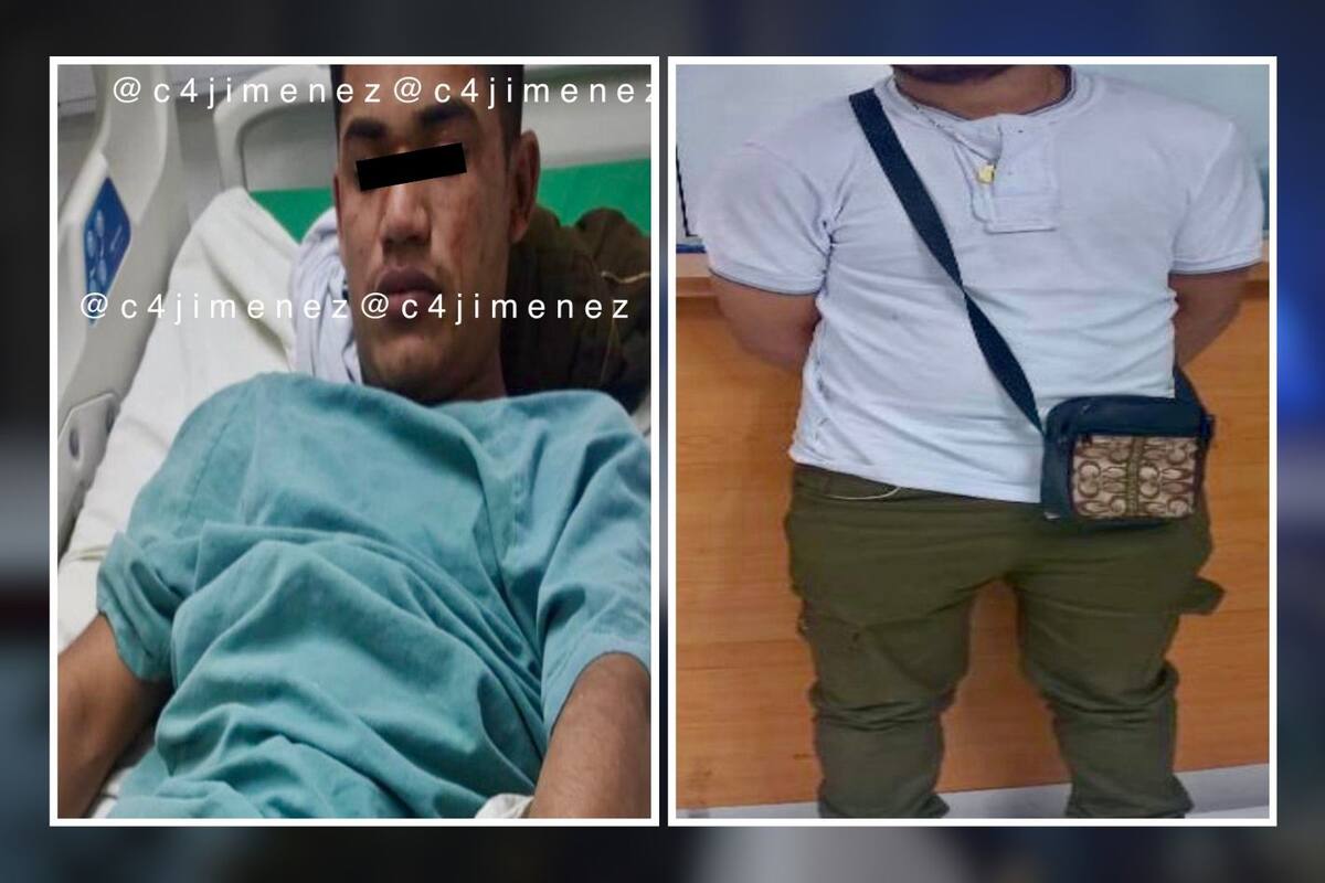 Asaltante venezolano se disparó accidentalmente en los testículos durante un robo en CDMX