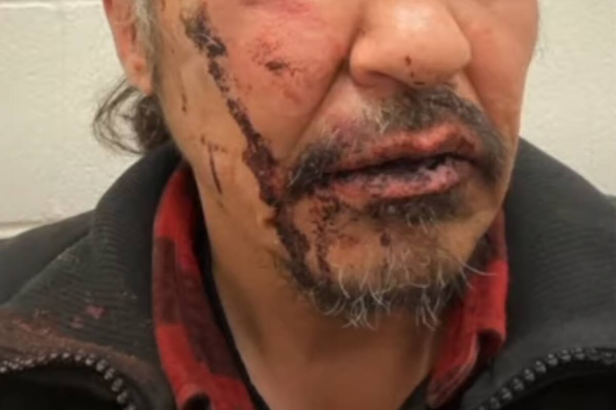 Jefe indígena denuncia que la policía lo golpeó por una presunta placa vencida en Canadá