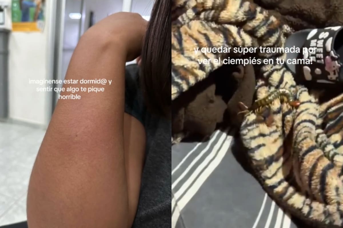 Le pica un insecto en la madrugada y termina en el hospital: ¡descubren que fue una escolopendra!