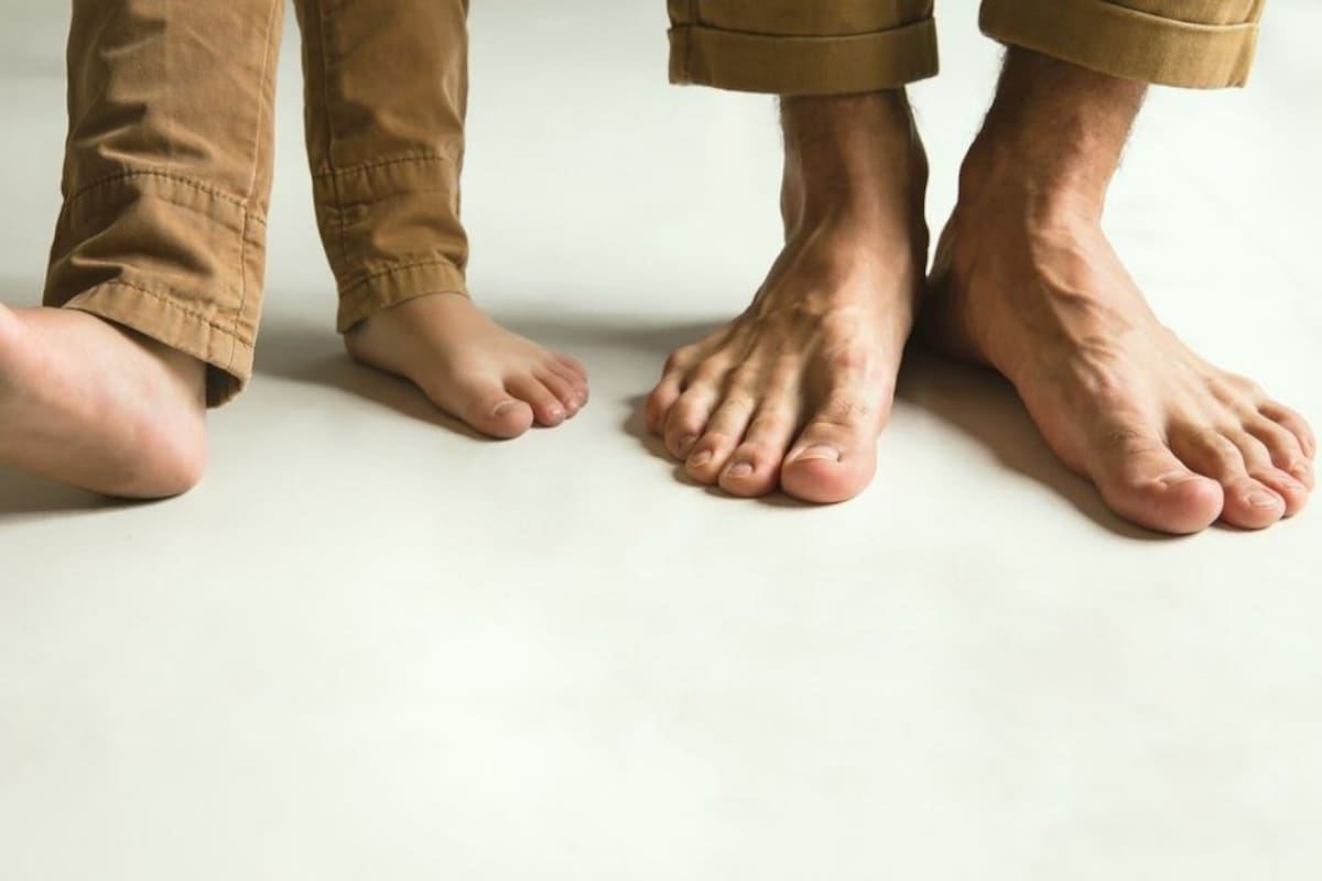 ¿Por qué algunas personas tienen la planta de los pies de color amarillo?