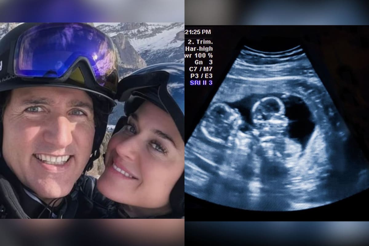 ¿Katy Perry está embarazada de gemelos de Justin Trudeau? Esto es todo lo que se sabe