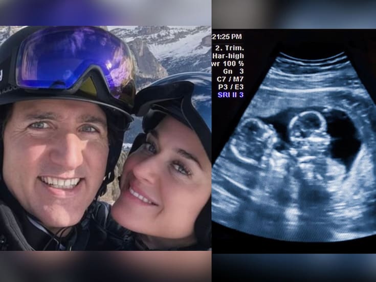 ¿Katy Perry está embarazada de gemelos de Justin Trudeau? Esto es todo lo que se sabe